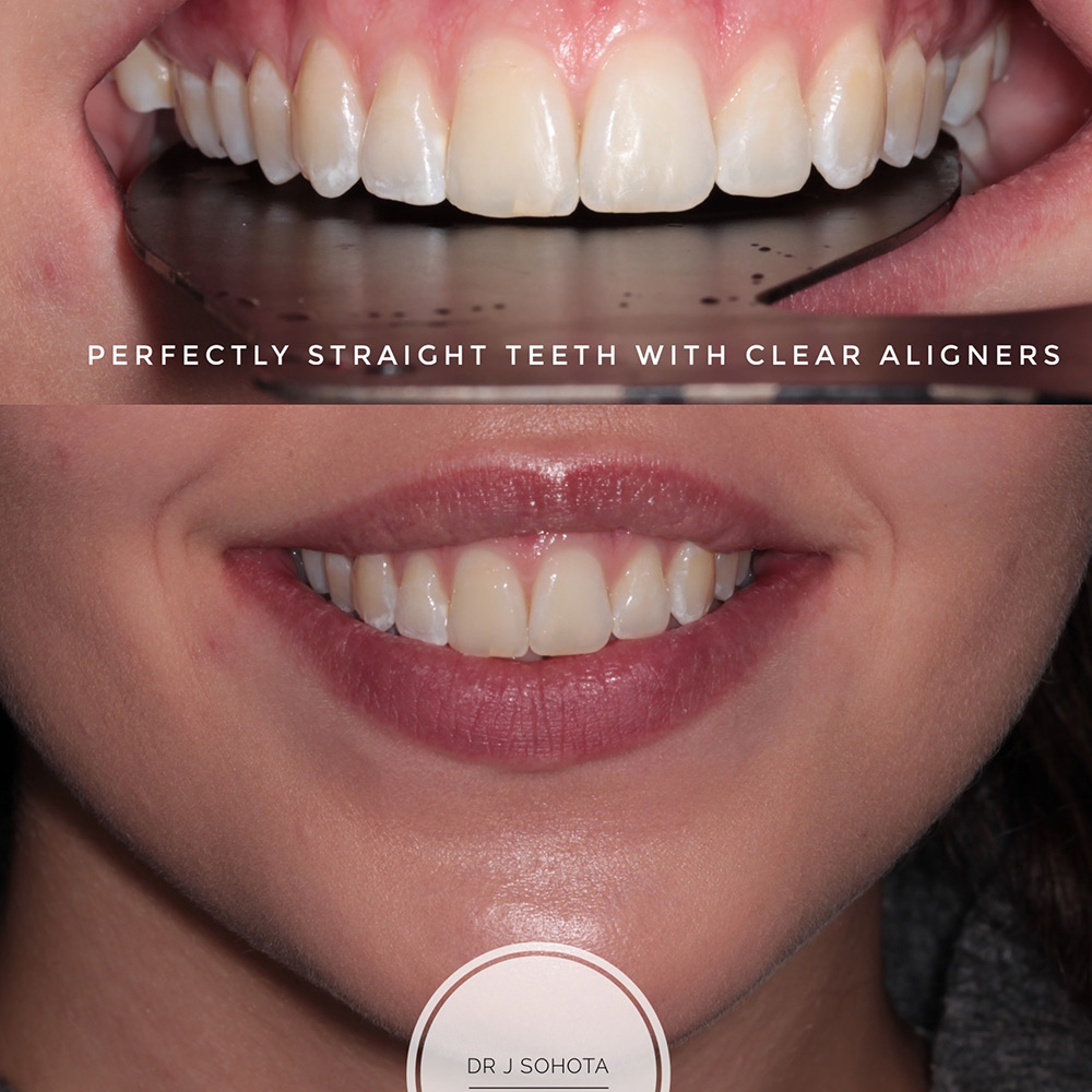 Cosmetic Dentist Rugby